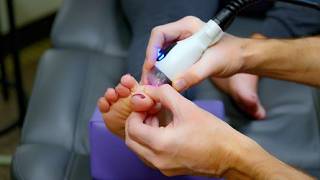 MiS Laser Therapy Accelerates Tissue Repair, Reduces Inflammation #kansascity #lasertherapy #foot