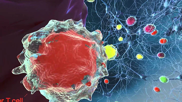 Dr. Ralph Kern Discusses the Immune Systems Role i...
