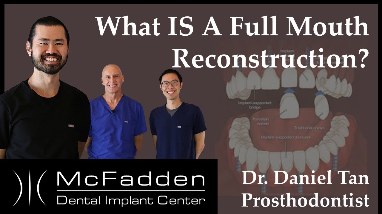 What Is A Full Mouth Reconstruction?