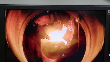 Free Fall Atomization Arc/Plasma Melting