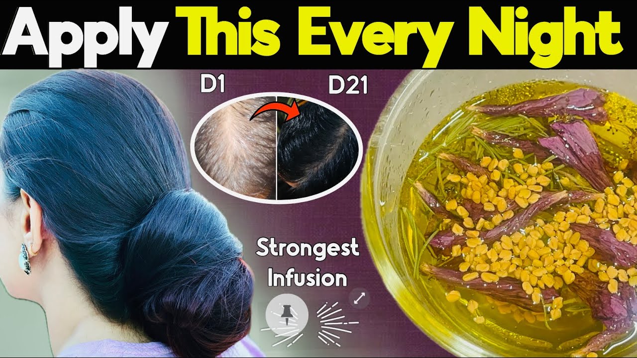 Overnight Hair Re-growth Challenge : Strongest DIY Oil & Toner to Grow Faster, Longer,Thicker Hair💕