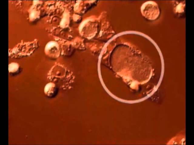 Time lapse video of the Chlamydia trachomatis developmental cycle.