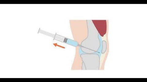 Aspiration bladder CPT code - simplify medical coding