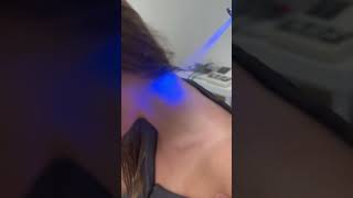 *Cryotherapy* Cold Therapy For Neck Pain Back Pain By Best Chiropractor Beverly Hills