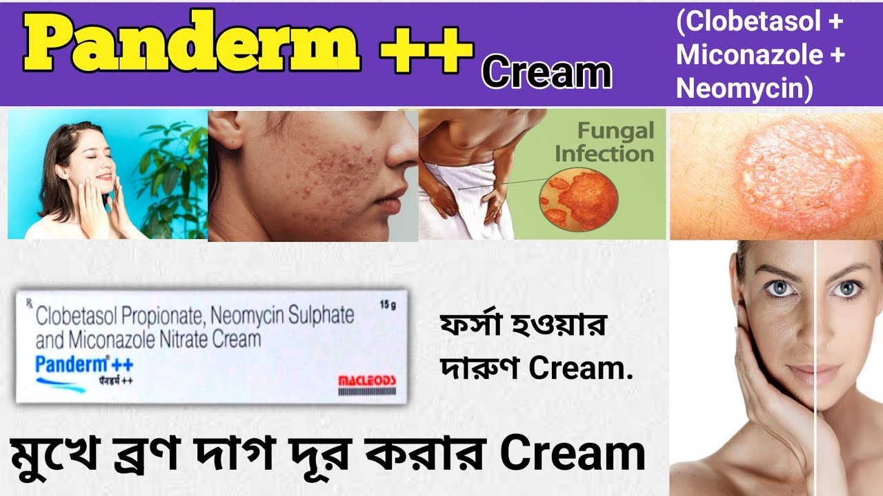 Panderm ++ Cream uses in Bangali // মুখে ব্রণ দাগ হাটাতে ব্যবহার হয় // Panderm plus Plus cream