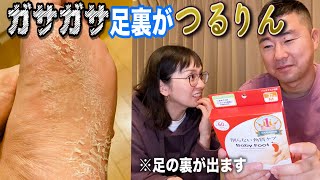 【ベビーフット】削らない角質ケア試したら凄過ぎた！！【閲覧注意】