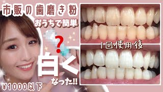 【驚愕‼︎】1回の歯磨きで歯が白く！ステイン着色汚れが気になる人必見！お家でお手軽【ホームホワイトニングケア】