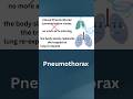 #types of Pnemothorax #Medical science #Medicos