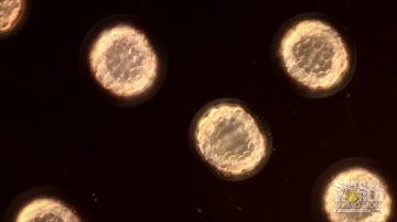 Fertilized Sea Urchin Eggs Dividing | 2017 Nikon Small World