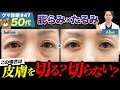 【目の下のたるみ】たるみが強いクマでも「切らない」クマ取り治療が可能か徹底解説！［クマ診断＃047］#目の下のたるみを取る方法#目の下のたるみ#クマ取り #美容整形 #湘南美容クリニック