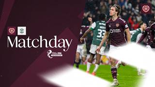 Matchday Hibernian H A Derby Victory