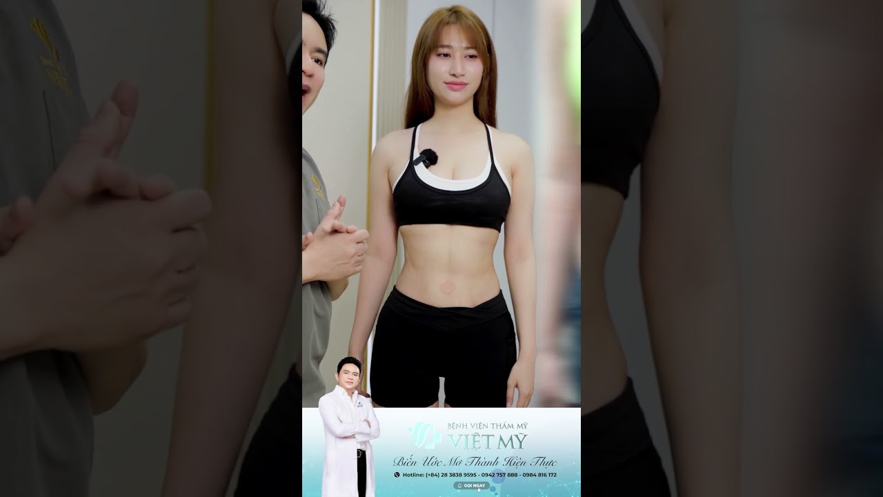 Hút mỡ vòng 2, tạo hình vòng 3 tại Bệnh viện Thẩm mỹ Việt Mỹ