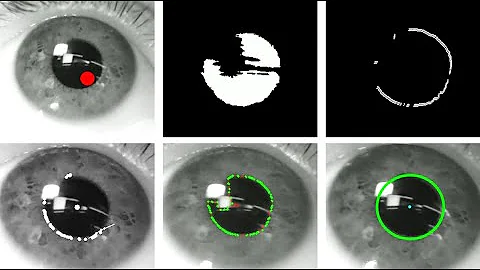 How Pupil Fitting Works in Eye Tracking Algorithms