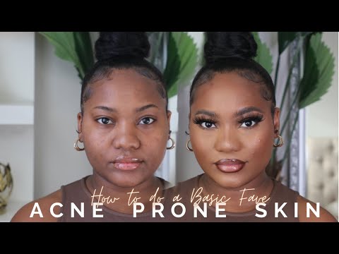 Download HOW TO: BASIC MAKEUP APPLICATION FOR ACNE PRONE SKIN 2022 | RAQUELLE EDUNJOBI