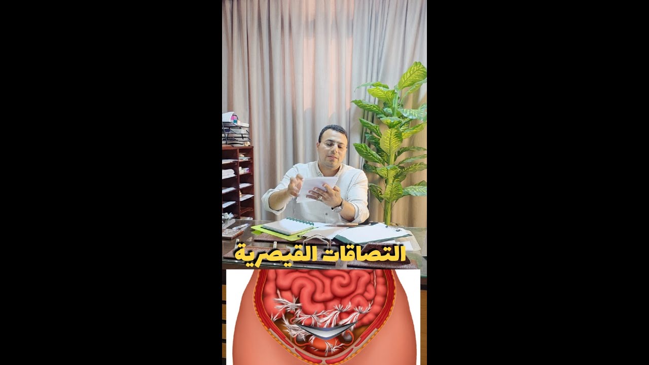 التصاقات القيصرية #رحلة_الحمل #اسابيع_الحمل