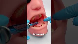 Inferior Alveolar Nerve Block #Golgran #Millennium