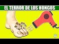 Quita los Hongos de Las Uñas de los Pies y Manos con este Ingrediente que tienes en tu Closet
