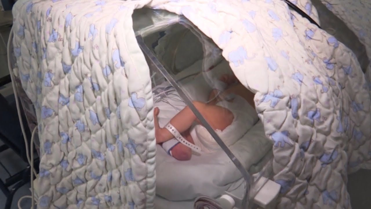 La lucha contra el ictus neonatal