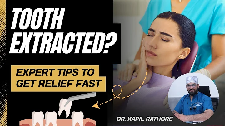 EXTRACTION | Post-op Instructions | MUST WATCH AFTER DENTAL EXTRACTION