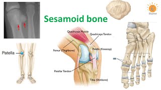 Sesamoid bone | Patella | Knee Cap | Dr Ghanshyam Jangid