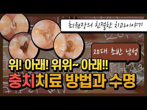 <strong>인레이</strong>, 크라운을 이용한 충치치료 증례입니다.