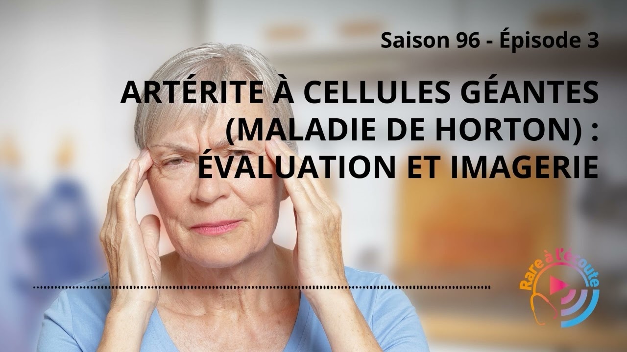 Maladie rare – Artérite à cellules géantes (maladie de Horton) : évaluation et imagerie