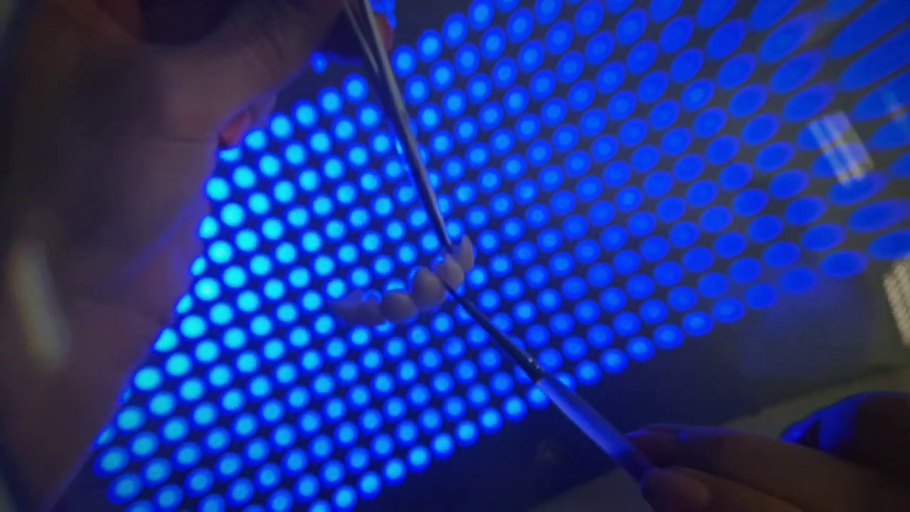 Implantologie basale et stratégique: Avis, risques et prix