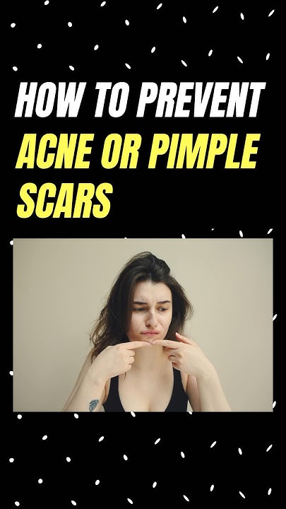 no-more-acne-scars-now-acne-pimple-dandifor-medical-medico