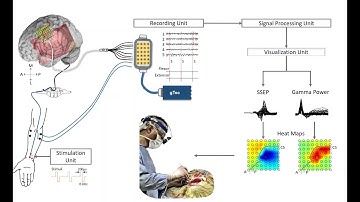 BCI Award 2022 Nomination - Real Time Intraoperative Consciousness Assessment