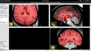 Tutorial - Cutting a chimpanzee brain stem in ITKSNAP
