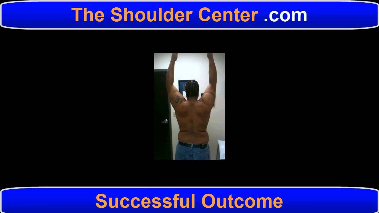 Best Shoulder Replacement Surgeon? 3178029686 YouTube