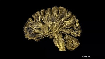 DeepEphys - Using machine learning for  biomarker discovery in human iPSC neuronal networks