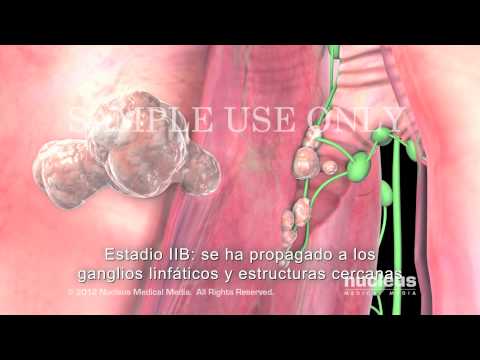 Video: 5 formas de desintoxicar los pulmones de forma natural