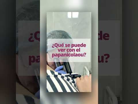 ¿Qué se puede