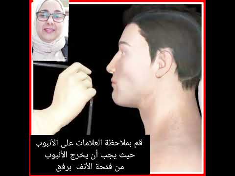    طريقة تركيب انبوبة التغذية من الانف
