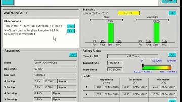 Interrogating a Microport pacemaker | Overview