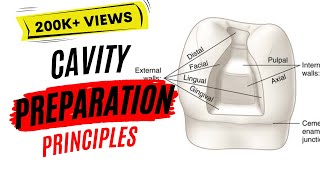 PRINCIPLES FOR TOOTH PREPARATION PART 1