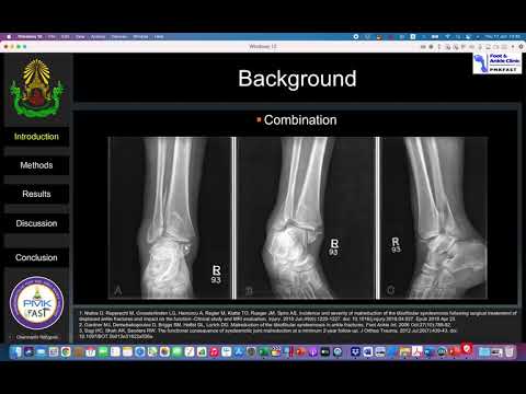 สอน online นักเรียนแพทย์ปี 5 เรื่อง ข้อเท้าหัก (Ankle fracture)