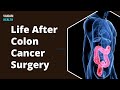 Life After Colon Cancer Surgery