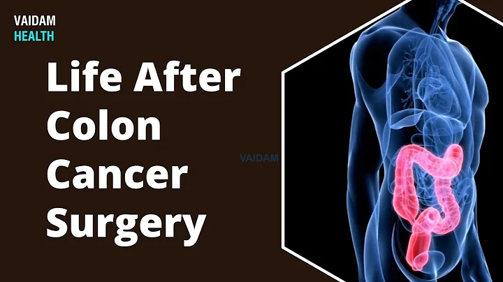 Life After Colon Cancer Surgery - DayDayNews