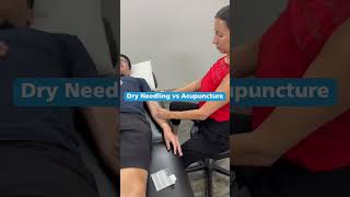 Dry Needling vs. Acupuncture: What’s the Difference?