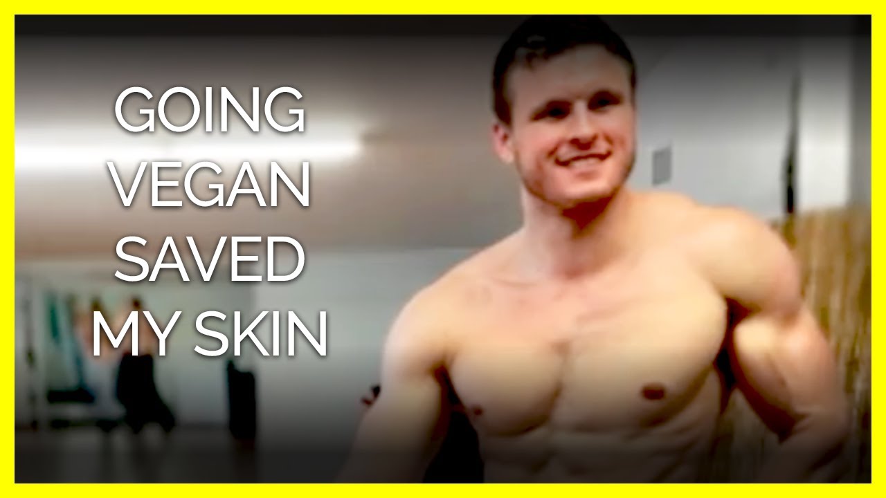 Going Vegan Cleared my Acne Body Builder Brian Turner YouTube