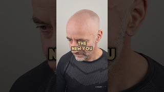 Scalp Micropigmentation In Kent, SMP, Scalp Tattoo, Hair Tattoo, Men's Hair Loss Solution In Kent.