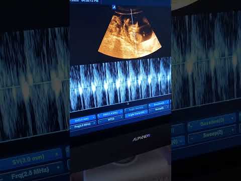 قمر الدار تعزف على الجيتار