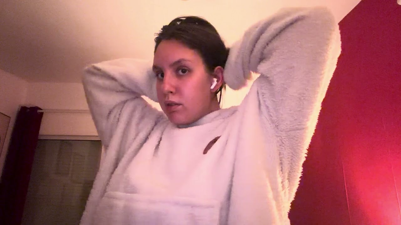 La pelade comment la cacher 