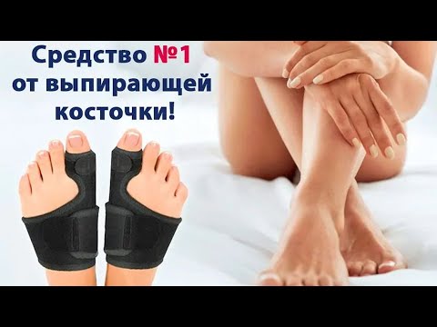 😷 Как правильно носить вальгусную шину 🔴 Шины ортопедические
