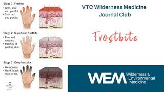 Vtc Wilderness Medicine Journal Club Frostbite