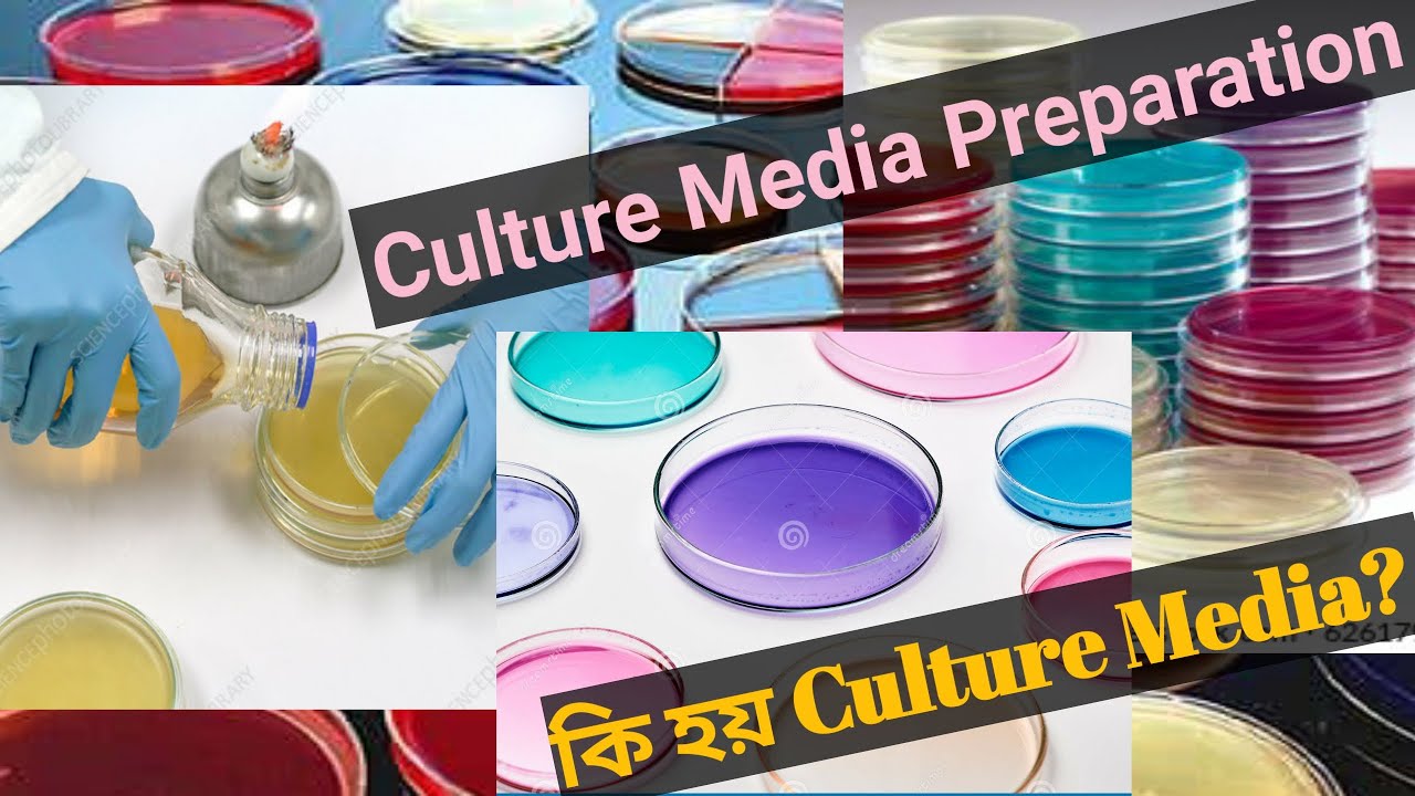 How to make culture media