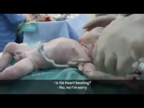 Video: Ինչպե՞ս է կոչվում ծննդաբերության փուլը, երբ երեխան ծնվում է: