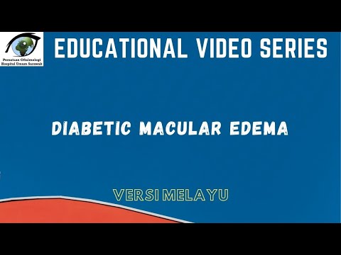 Ophthalmology Educational Video Series- DIABETIC MACULAR EDEMA (MALAY)